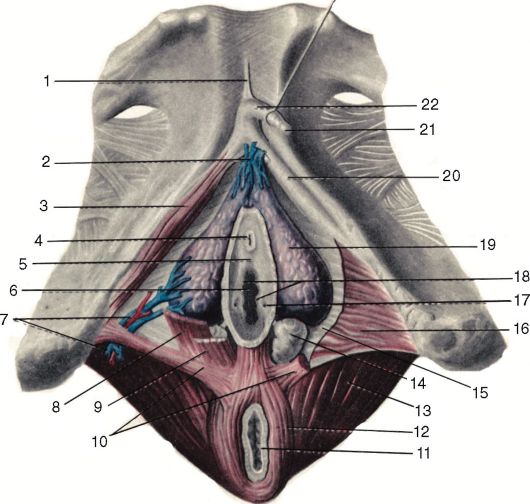 Большая Железа Преддверия Влагалища