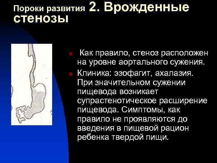 Электрорассечение Врожденный Стеноз Трахеи