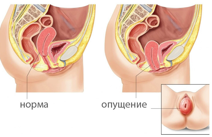 Секс Шрек И Фиона