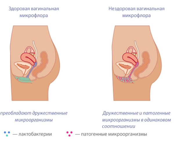 Чем Отличается Девственница От Недевственницы