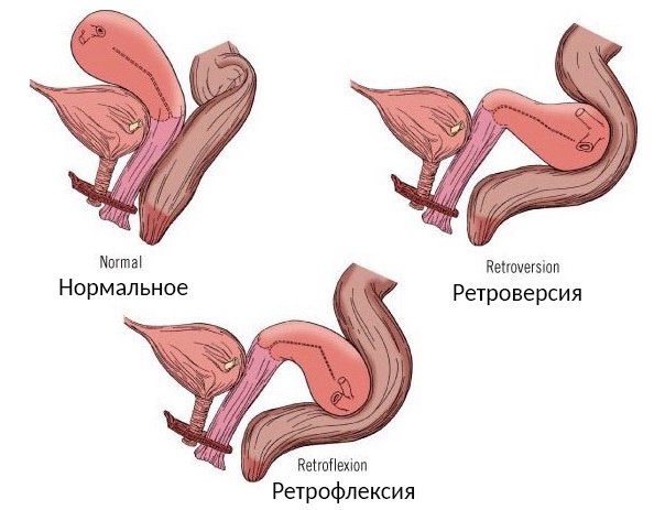 Дергает Во Влагалище При Беременности