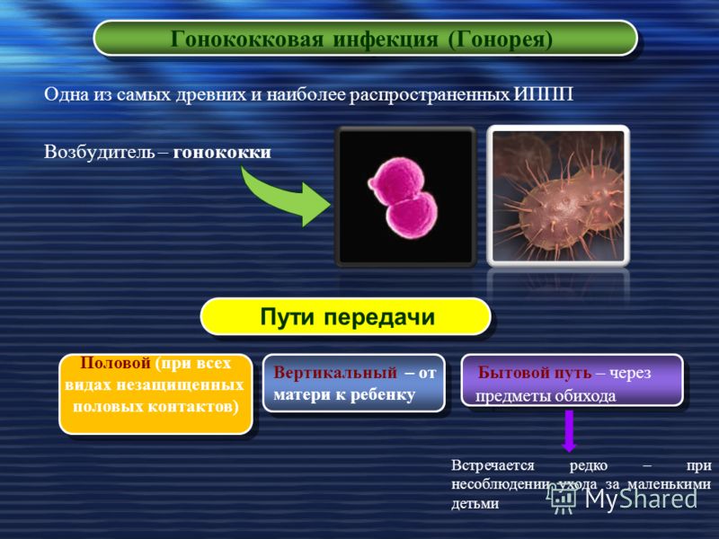 Иппп Оральный Секс Микоплазма