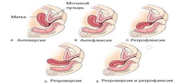 Лучшие Позы При Загнутом Влево Члене