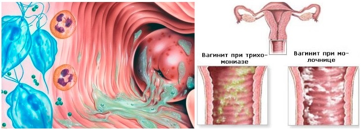 Скрытая Камера На Женском Массажныи Салоне Видео