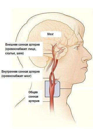 Оргазм Сонные Артерии