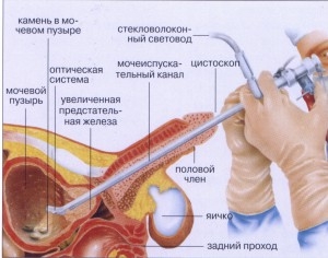 Польза И Вред От Глотания Мужской Спермы