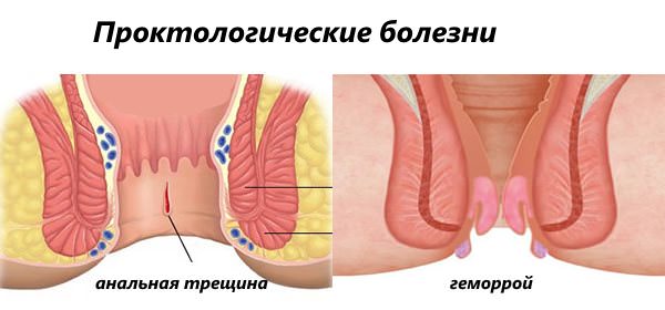 Алена Воданаева И Все Ее Мужики Секс