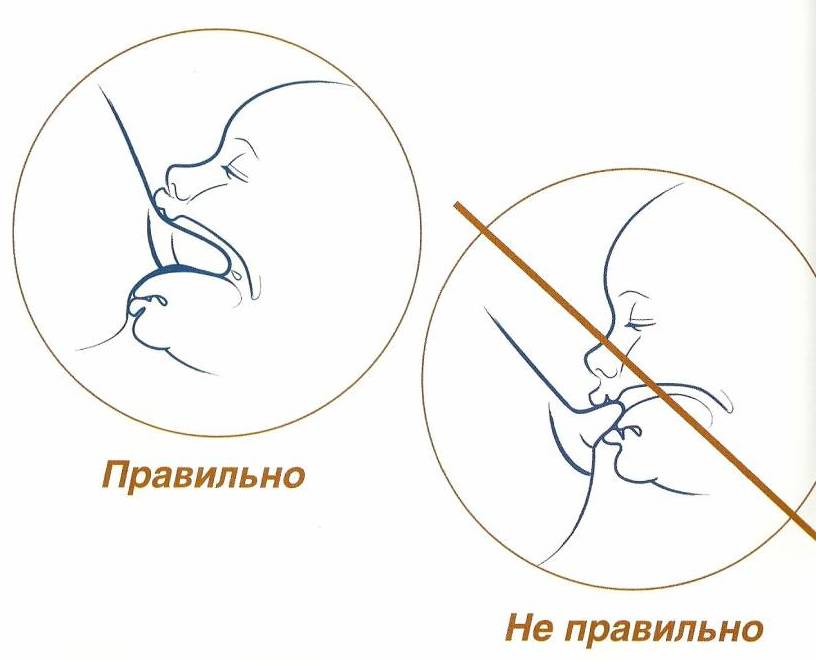 Правильное Прикладывание К Груди Фото