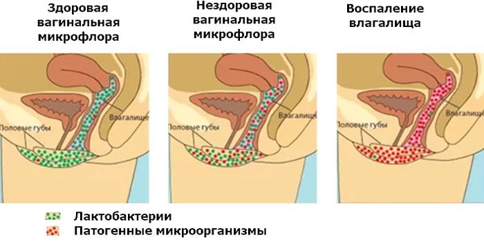 Забеременнеть При Анальном Сексе