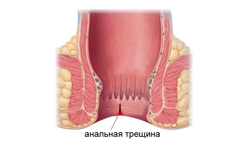 Стейси Сильверстоун Получает Анальный Кайф