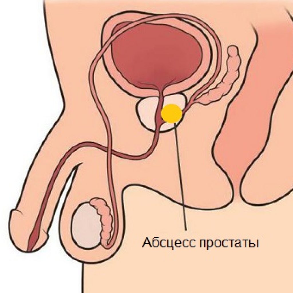 Секс С Полным Мочевым