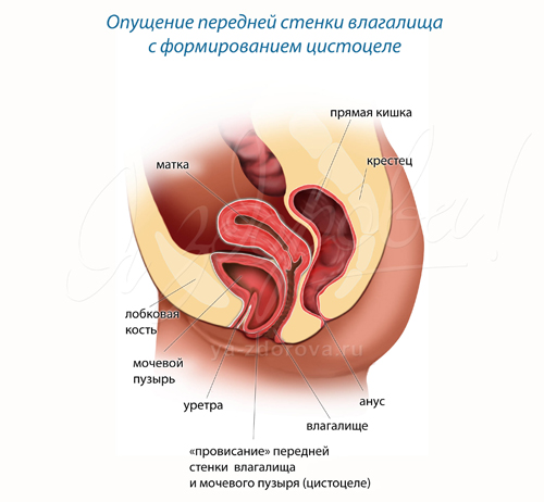 Щипет Вход Во Влагалище