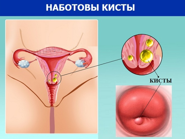 Шишечка Около Влагалища