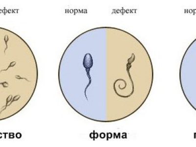 Сперма Потемнела