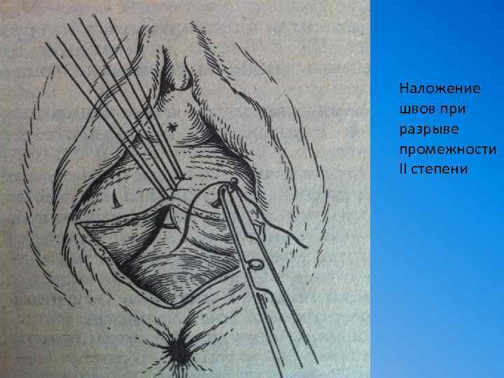 Страны Члены Лаи